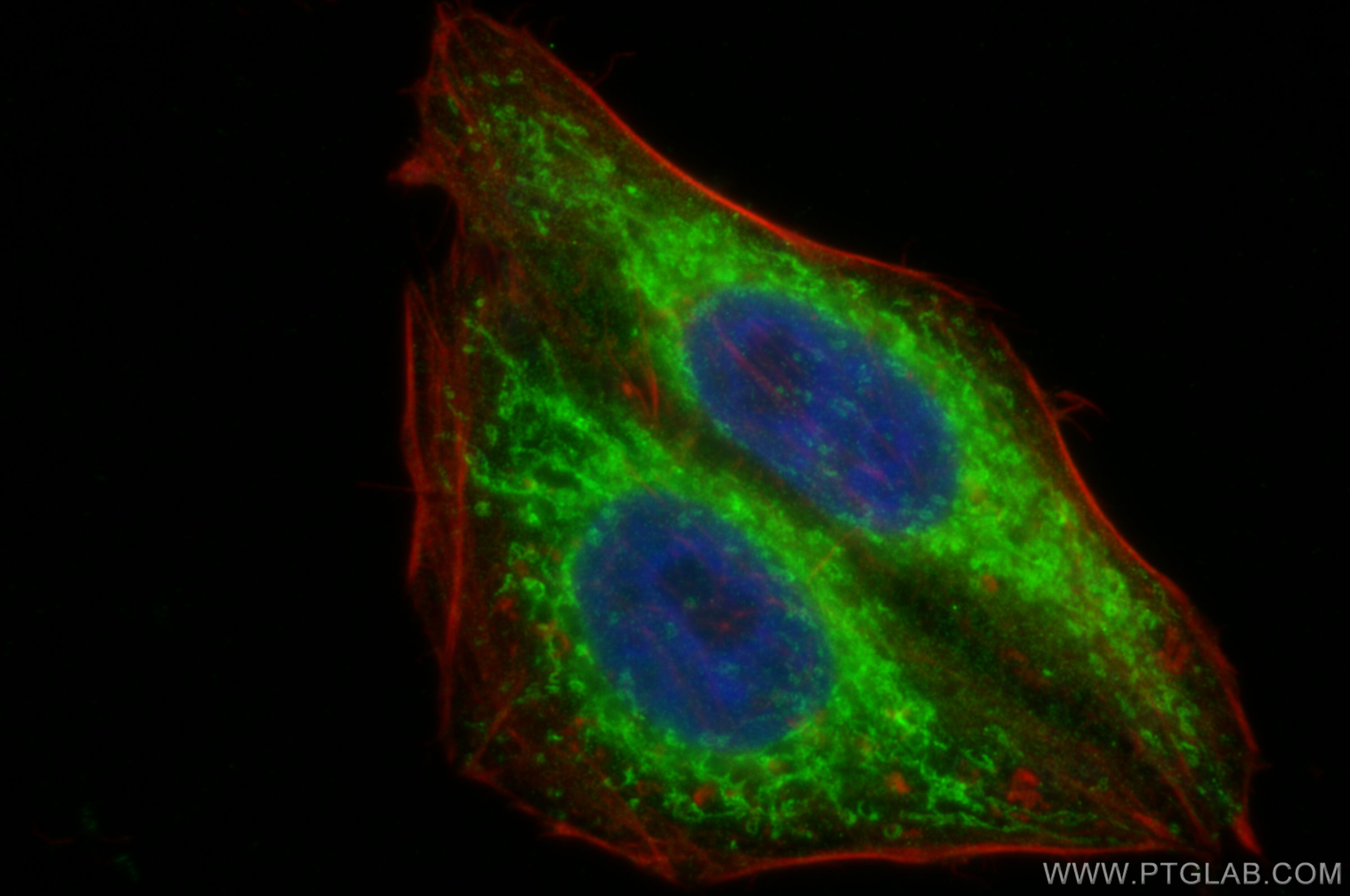 IF Staining of HepG2 using 31132-1-AP