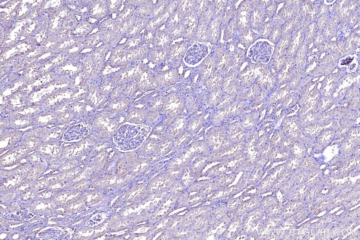 IHC staining of human kidney using 55410-1-AP IHC staining of human kidney using 55410-1-AP