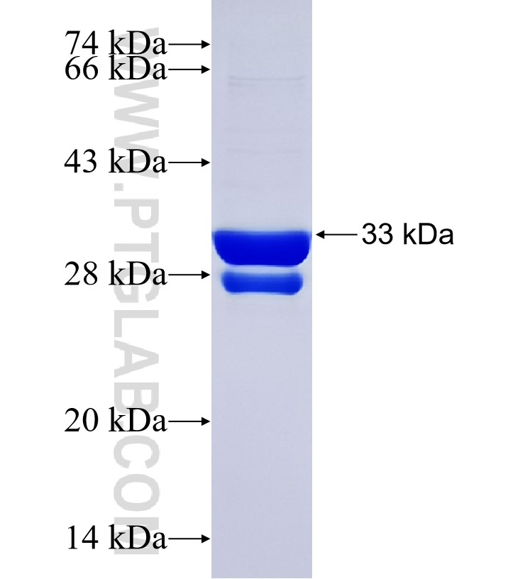 ND5 fusion protein Ag34495 SDS-PAGE ND5 fusion protein Ag34495 SDS-PAGE