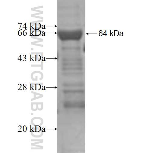NDC80 fusion protein Ag4535 SDS-PAGE NDC80 fusion protein Ag4535 SDS-PAGE