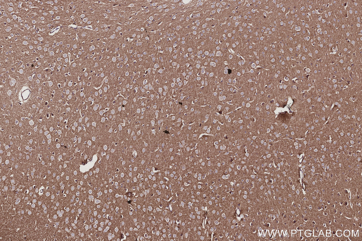 IHC staining of mouse brain using 10233-1-AP