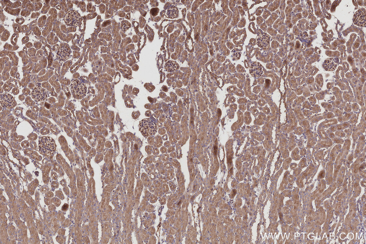 IHC staining of mouse kidney using 10233-1-AP