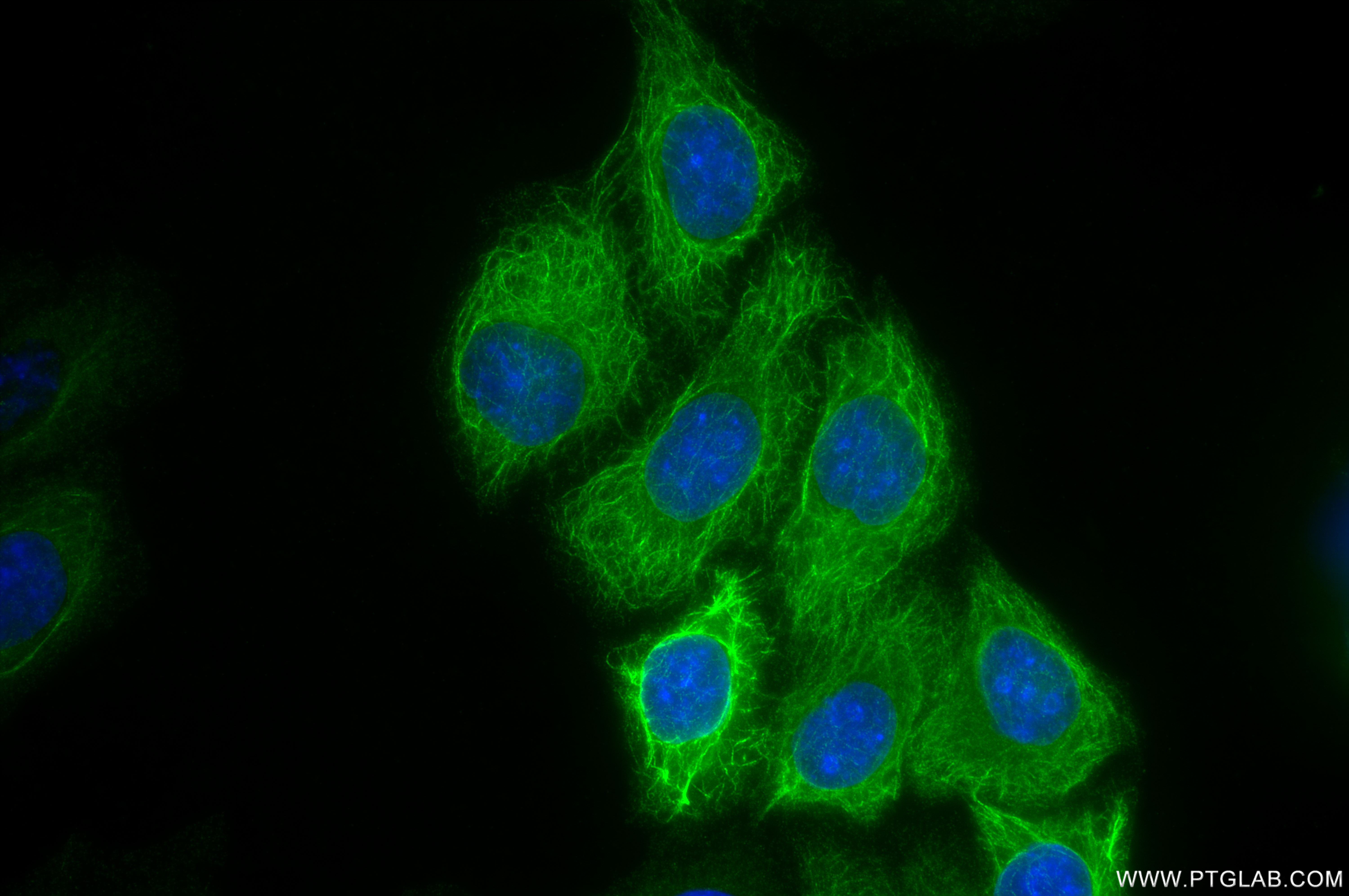 IF Staining of HepG2 using 84799-4-RR (same clone as 84799-4-PBS)