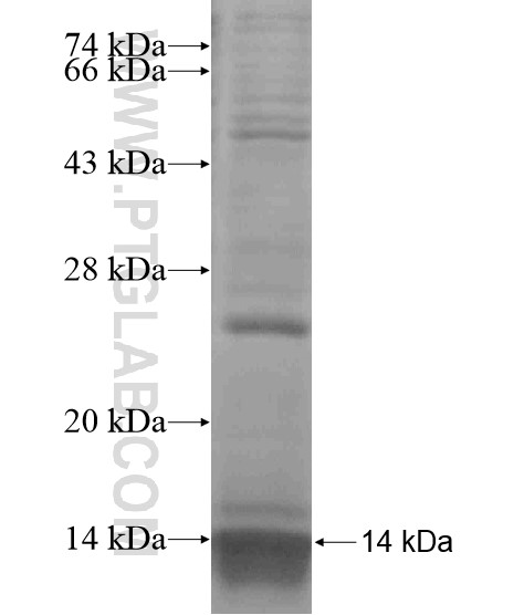 NDE1 fusion protein Ag19175 SDS-PAGE NDE1 fusion protein Ag19175 SDS-PAGE