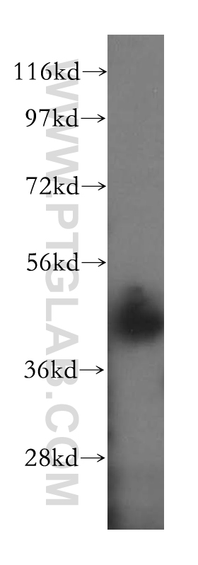 WB analysis of human brain using 17262-1-AP