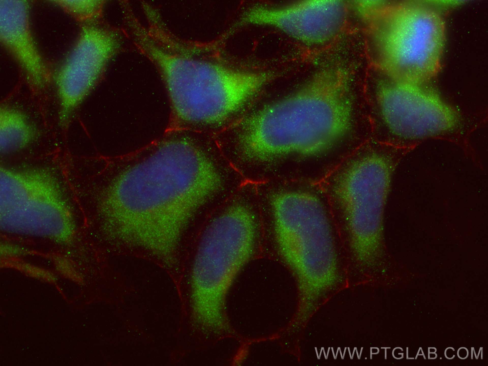 IF Staining of HEK-293 using 15602-1-AP