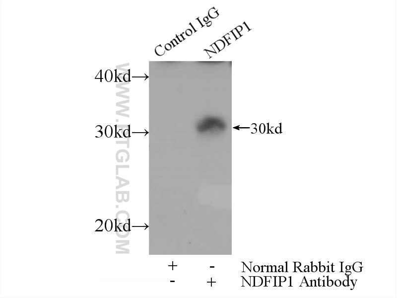 IP experiment of HEK-293 using 15602-1-AP
