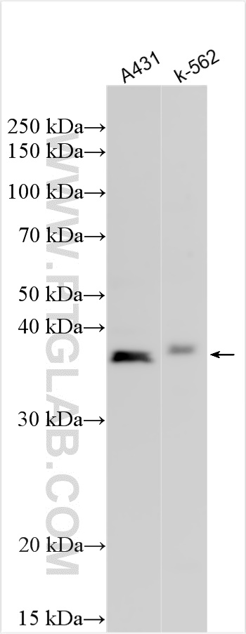 WB analysis using 32043-1-AP