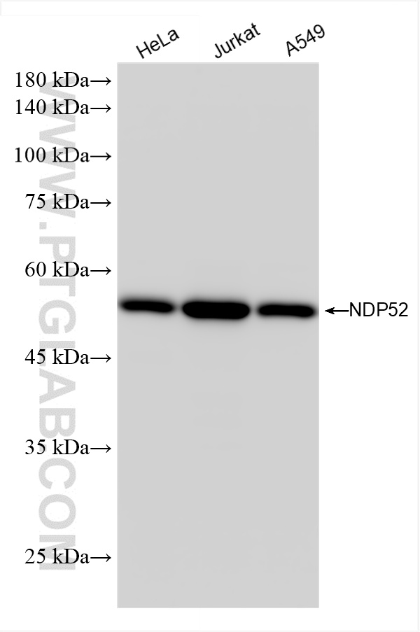 Various lysates were subjected to SDS PAGE followed by western blot with 86167-1-RR (NDP52 antibody) at dilution of 1:10000 incubated at room temperature for 1.5 hours. WB analysis using 86167-1-RR