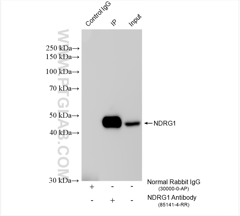 IP experiment of HeLa using 85141-4-RR (same clone as 85141-4-PBS)