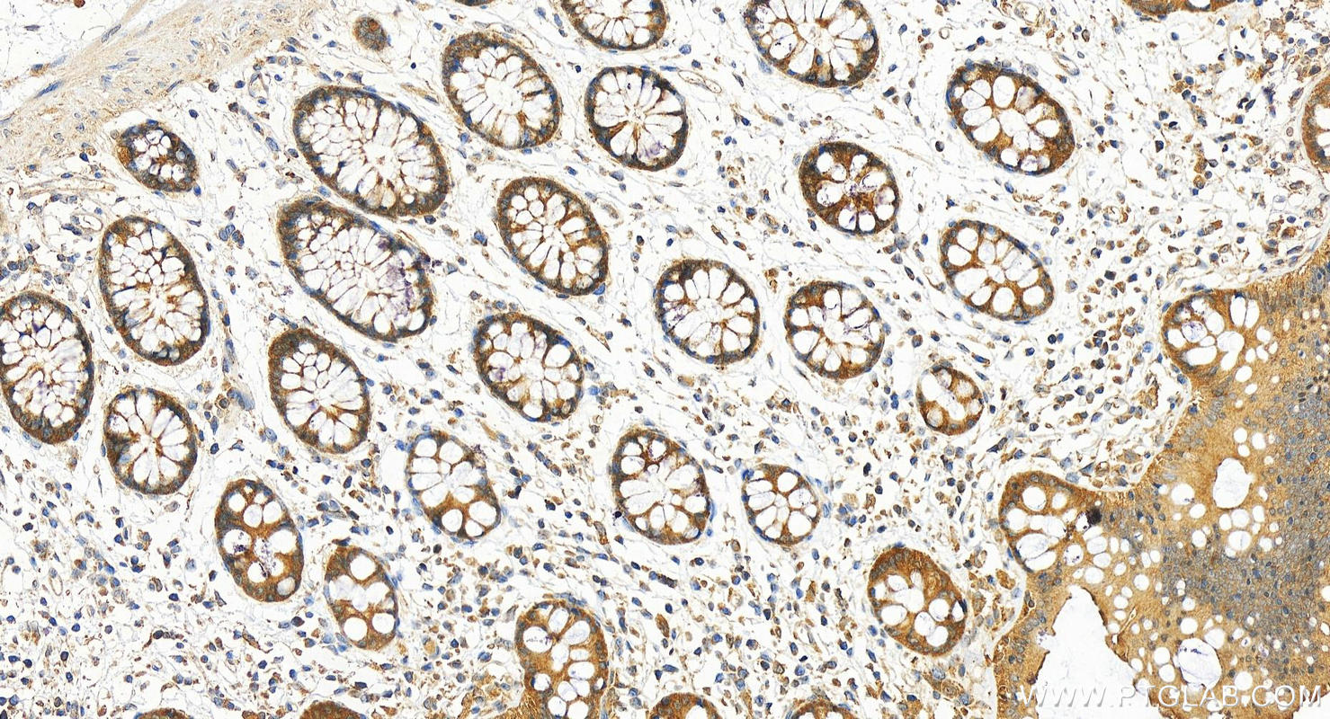 IHC staining of human colon using 31421-1-AP