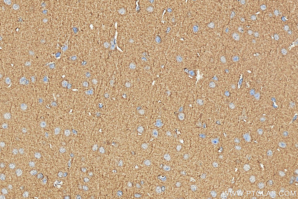 IHC staining of mouse brain using 31421-1-AP (same clone as 31421-1-PBS) IHC staining of mouse brain using 31421-1-AP (same clone as 31421-1-PBS)