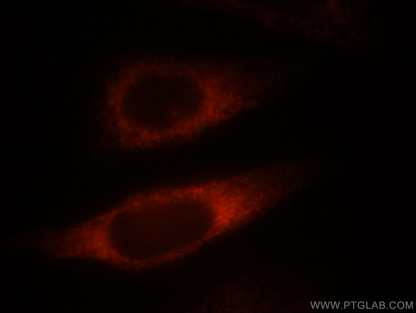 IF Staining of HepG2 using 12184-1-AP