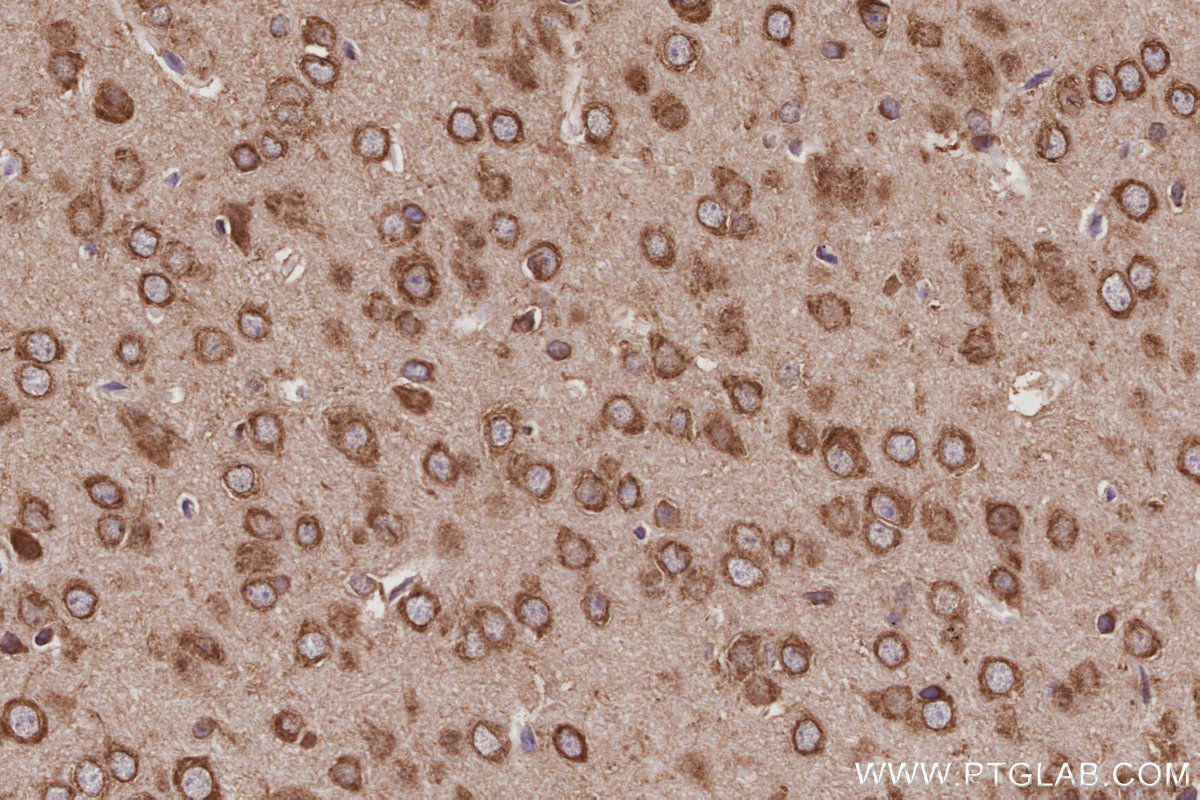 IHC staining of mouse brain using 12184-1-AP IHC staining of mouse brain using 12184-1-AP