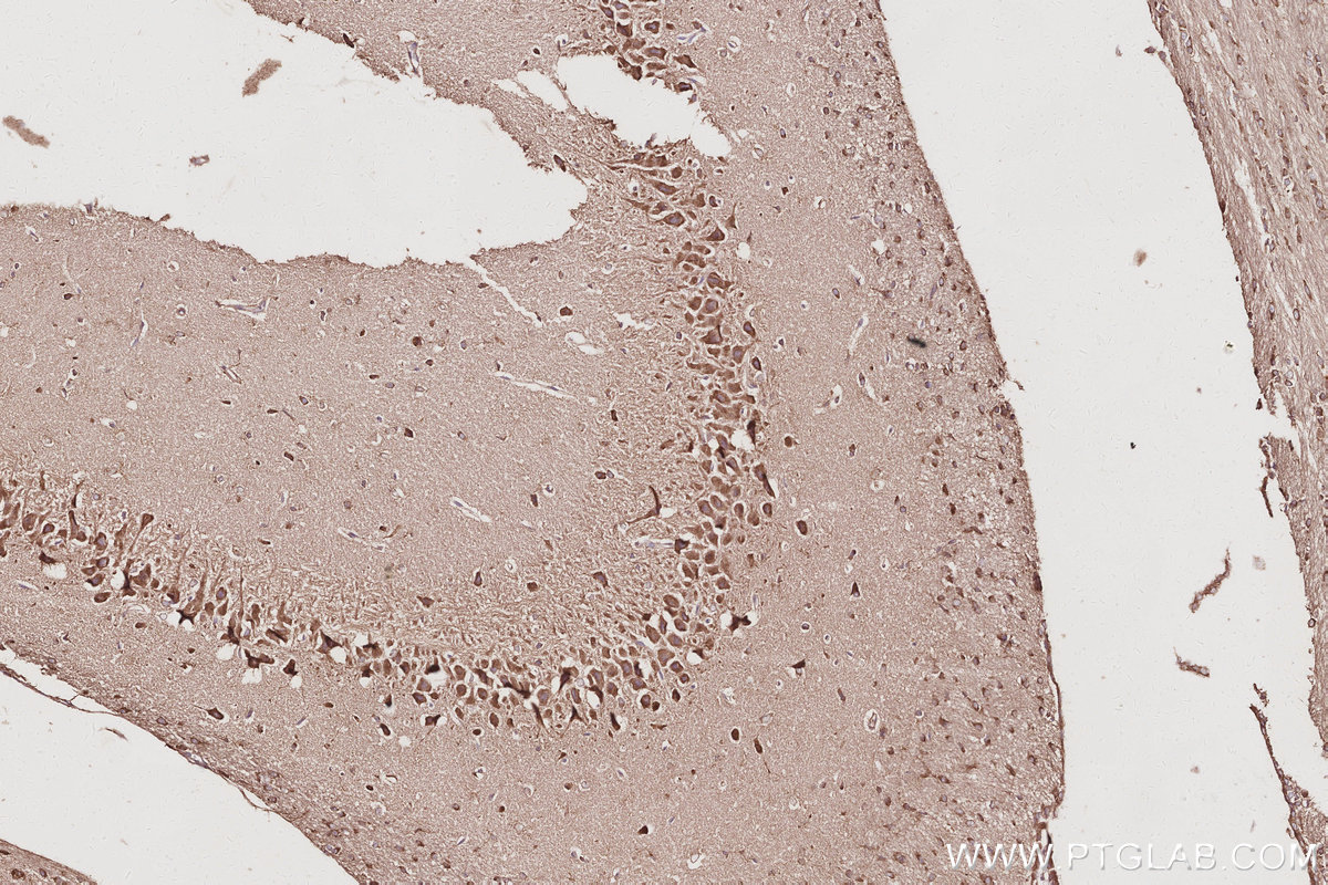 IHC staining of rat brain using 12184-1-AP IHC staining of rat brain using 12184-1-AP