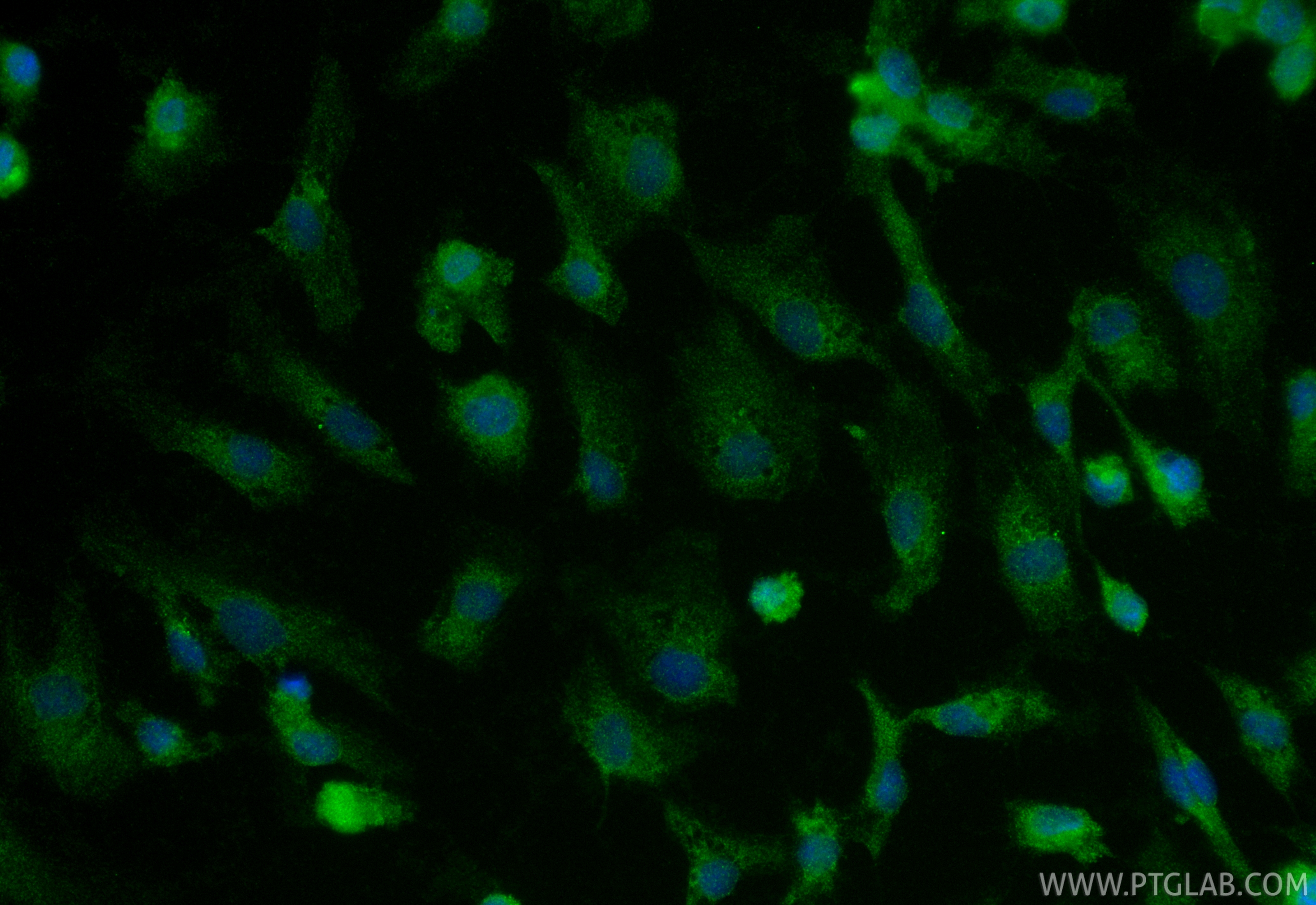 IF Staining of HUVEC using 21569-1-AP (same clone as 21569-1-PBS) IF Staining of HUVEC using 21569-1-AP (same clone as 21569-1-PBS)
