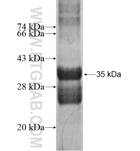 NDST3 fusion protein Ag16091 SDS-PAGE NDST3 fusion protein Ag16091 SDS-PAGE