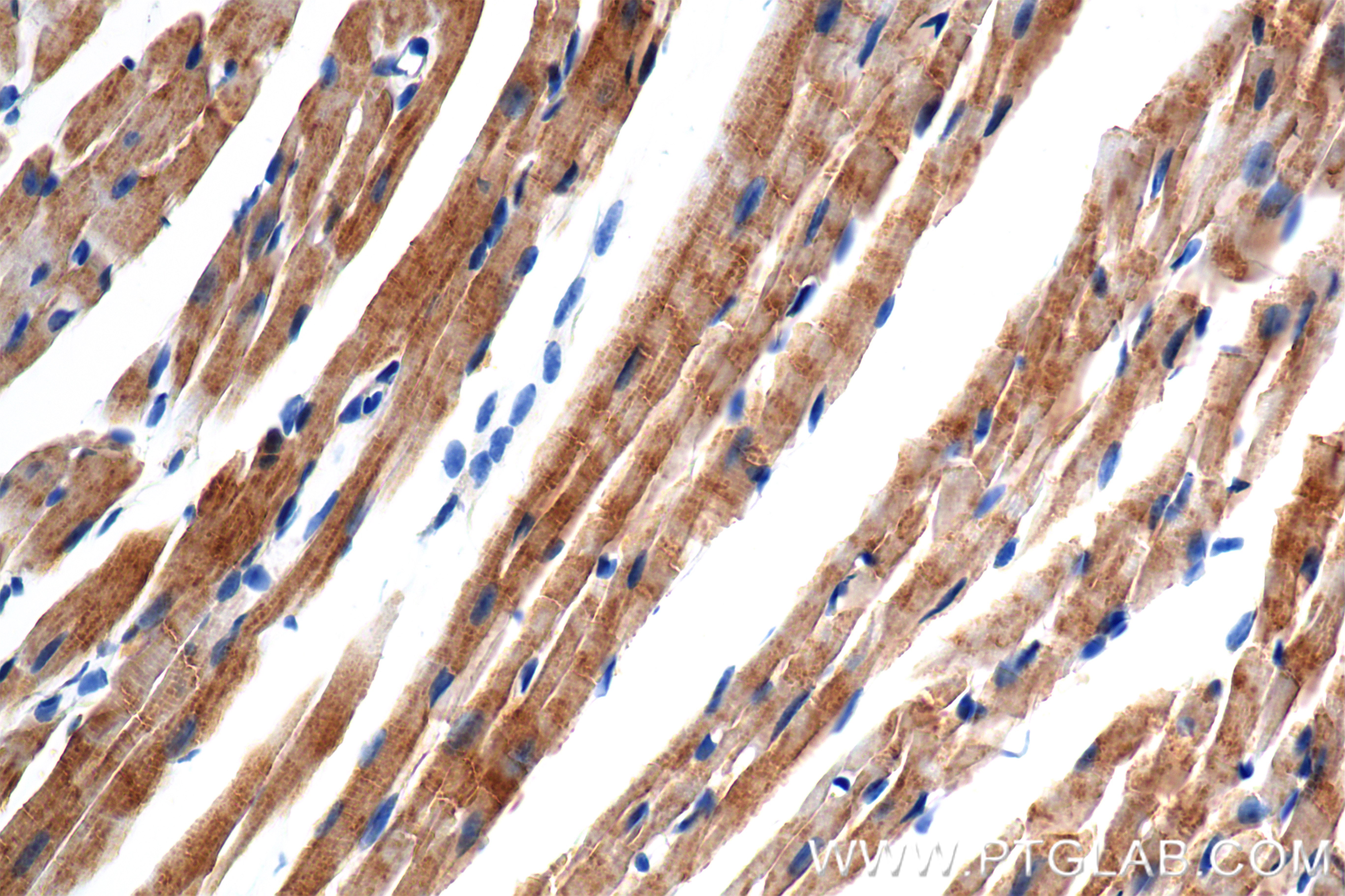 Immunohistochemical analysis of paraffin-embedded mouse heart tissue slide using 86470-1-RR (NDUFA1 antibody) at dilution of 1:1000 (under 40x lens). Heat mediated antigen retrieval with Tris-EDTA buffer (pH 9.0). IHC staining of mouse heart using 86470-1-RR