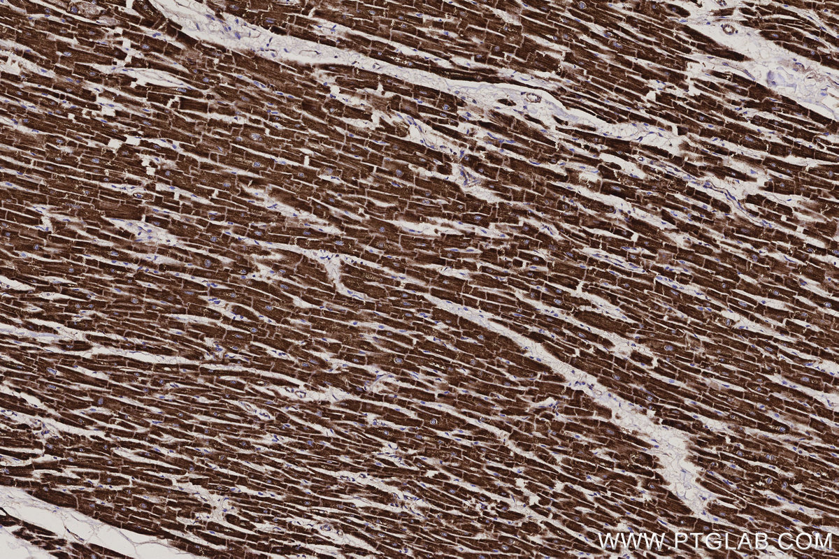 IHC staining of human heart using 86470-1-RR