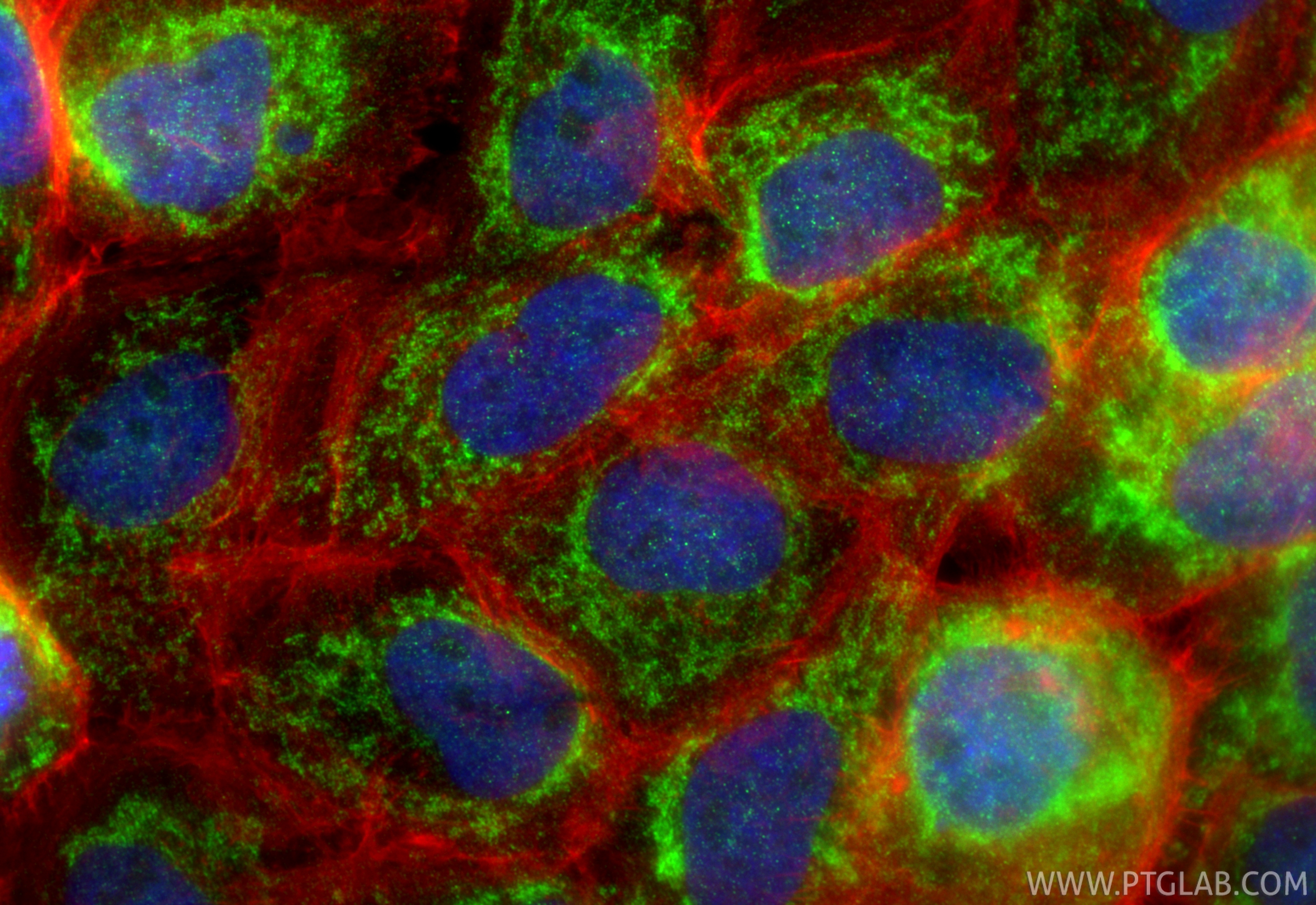 IF Staining of A431 using 32947-1-AP (same clone as 32947-1-PBS) IF Staining of A431 using 32947-1-AP (same clone as 32947-1-PBS)