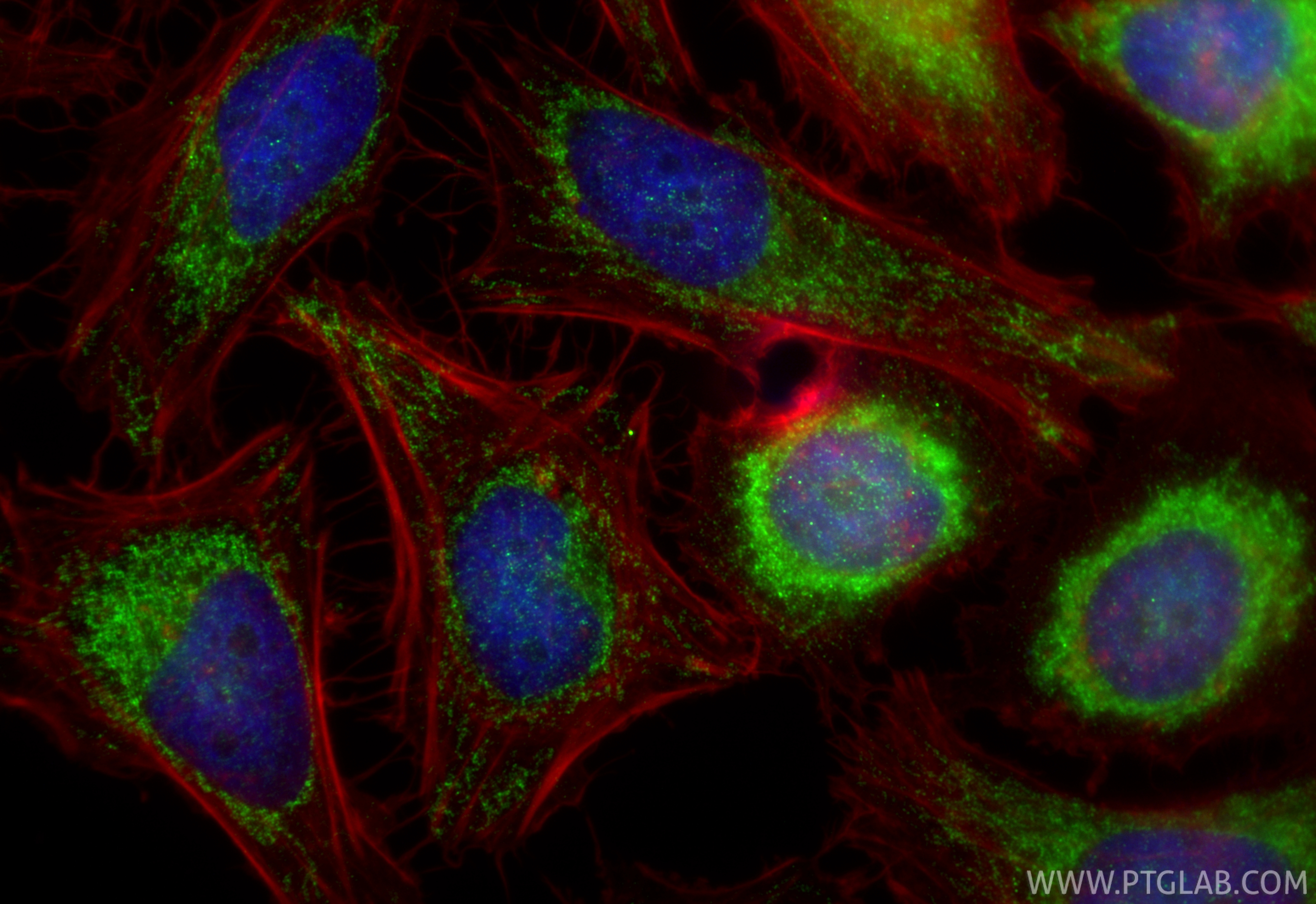 IF Staining of HeLa using 32947-1-AP (same clone as 32947-1-PBS) IF Staining of HeLa using 32947-1-AP (same clone as 32947-1-PBS)