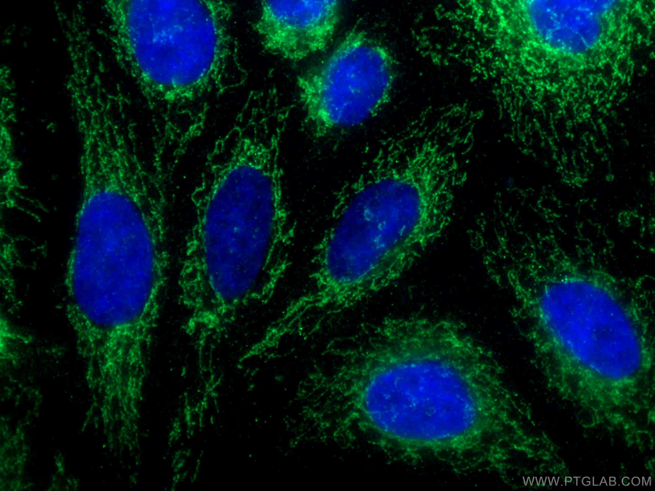 IF Staining of HepG2 using 15793-1-AP