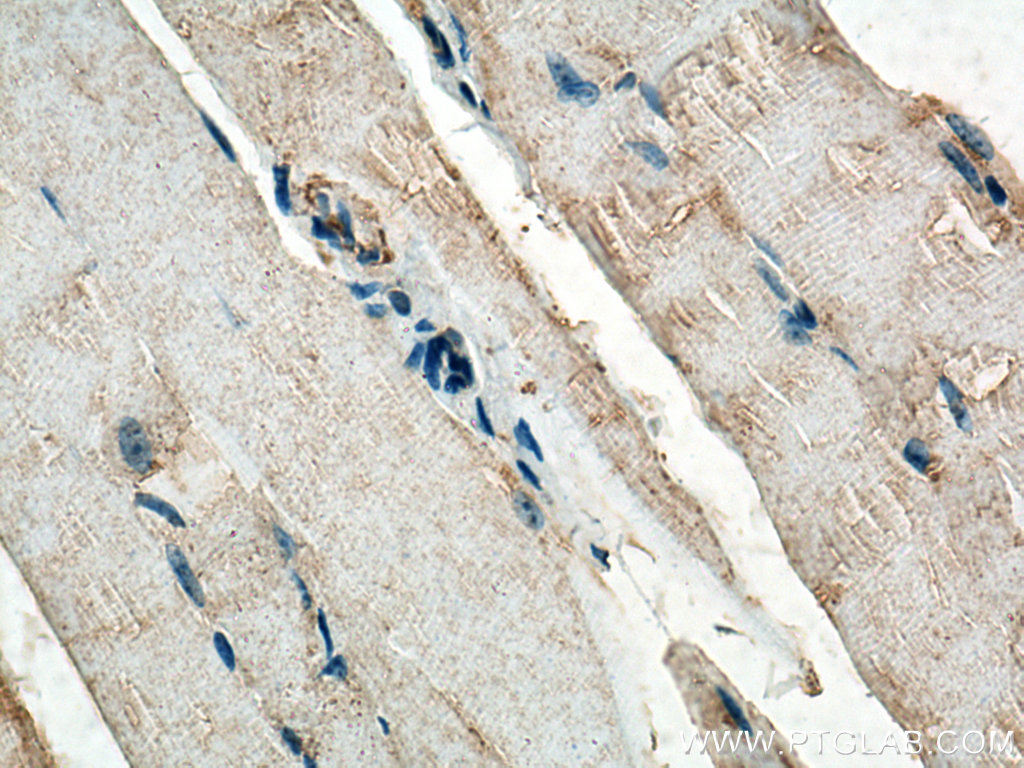 IHC staining of mouse skeletal muscle using 15793-1-AP