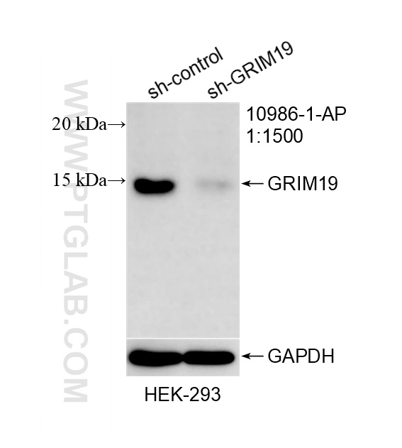 WB result of GRIM19 antibody (10986-1-AP; 1:1500; incubated at room temperature for 1.5 hours) with sh-Control and sh-GRIM19 transfected HEK-293 cells. WB analysis of HEK-293 using 10986-1-AP