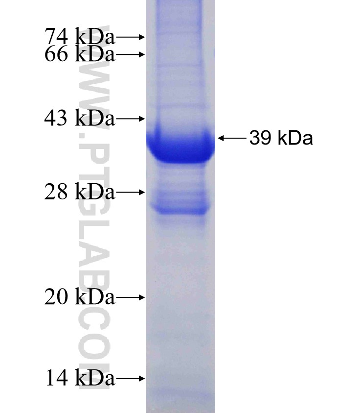 GRIM19 fusion protein Ag1435 SDS-PAGE