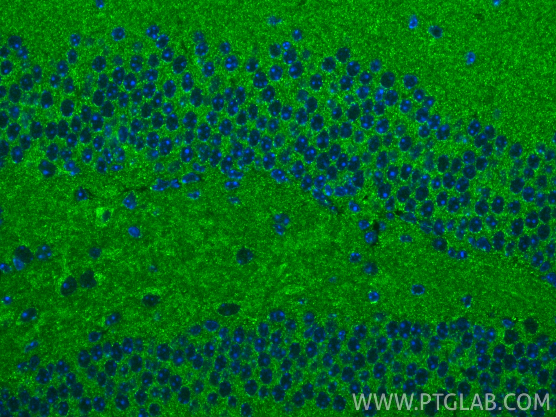 IF Staining of mouse brain using 15889-1-AP IF Staining of mouse brain using 15889-1-AP