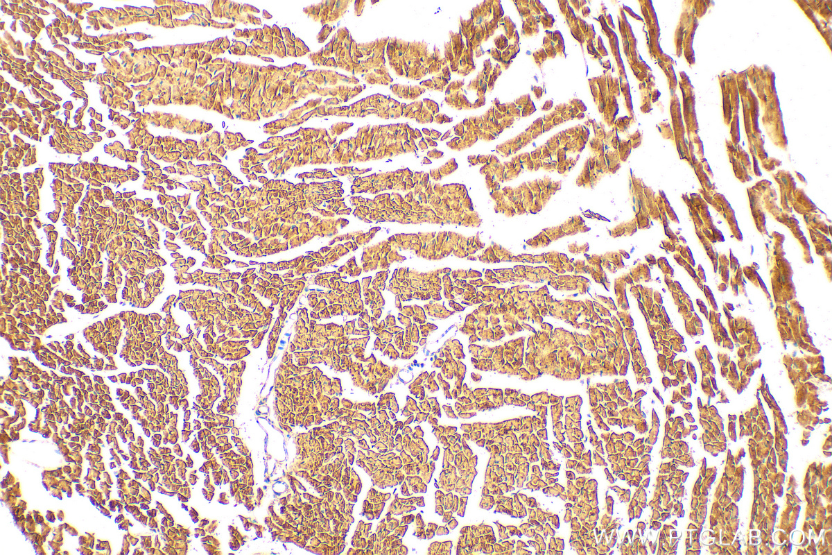 IHC staining of mouse heart using 15889-1-AP