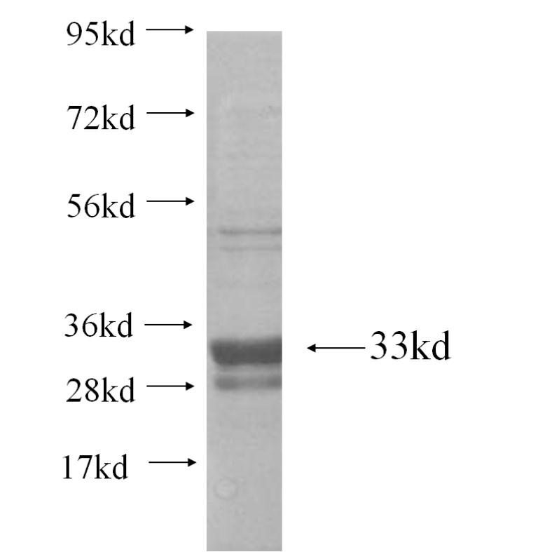 NDUFA3 fusion protein Ag10912 SDS-PAGE