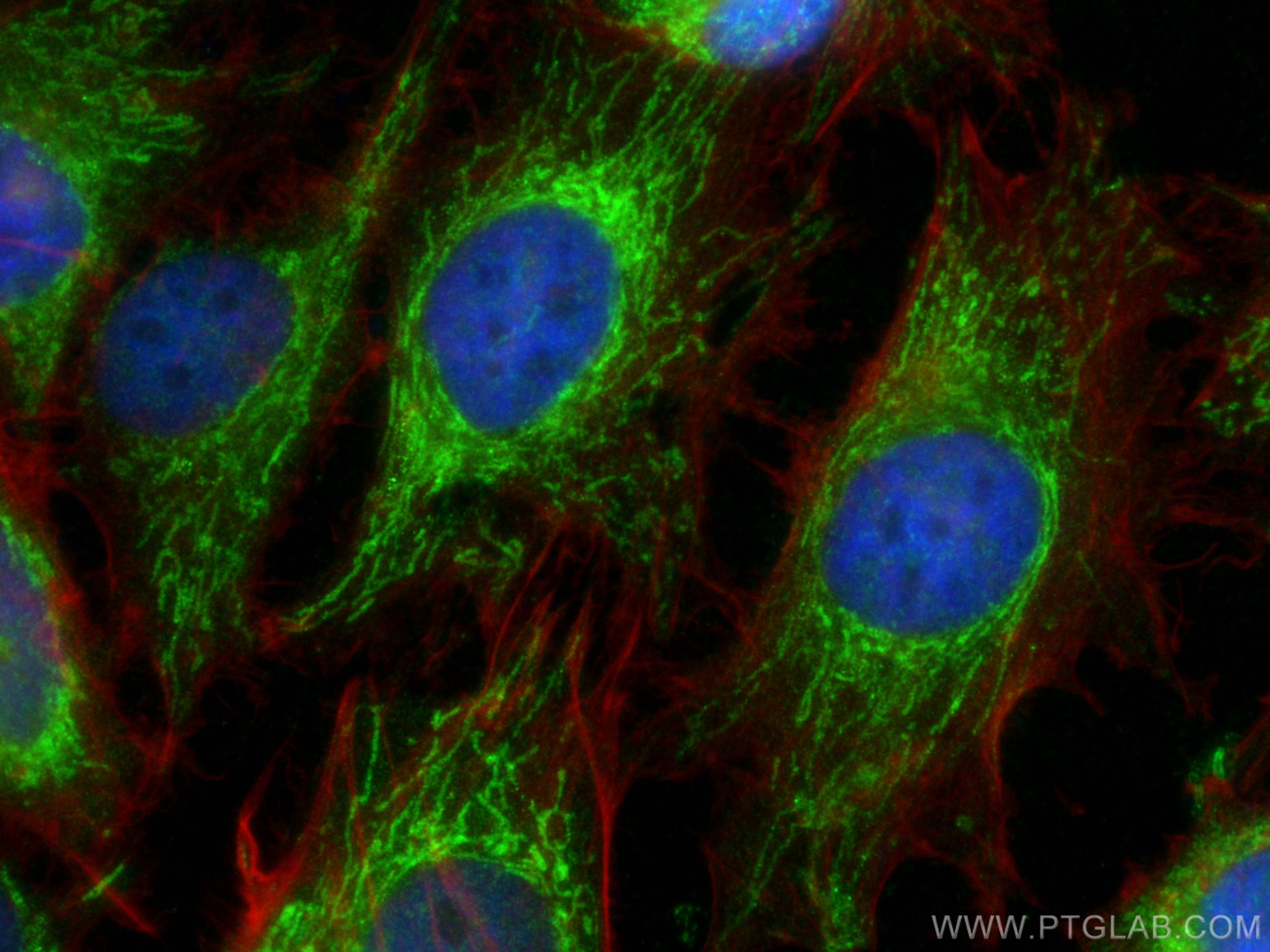 IF Staining of HeLa using 16480-1-AP