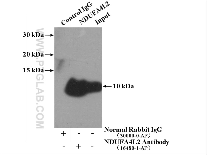 IP experiment of HeLa using 16480-1-AP