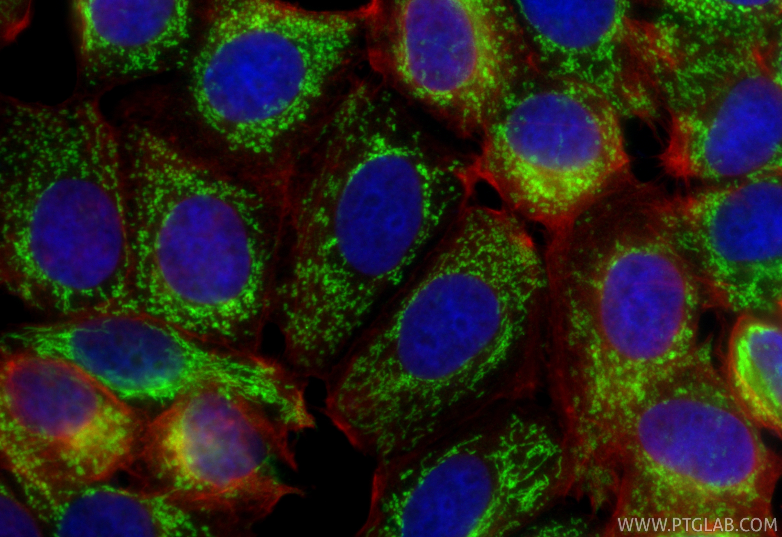 IF Staining of MCF-7 using 66050-1-Ig IF Staining of MCF-7 using 66050-1-Ig