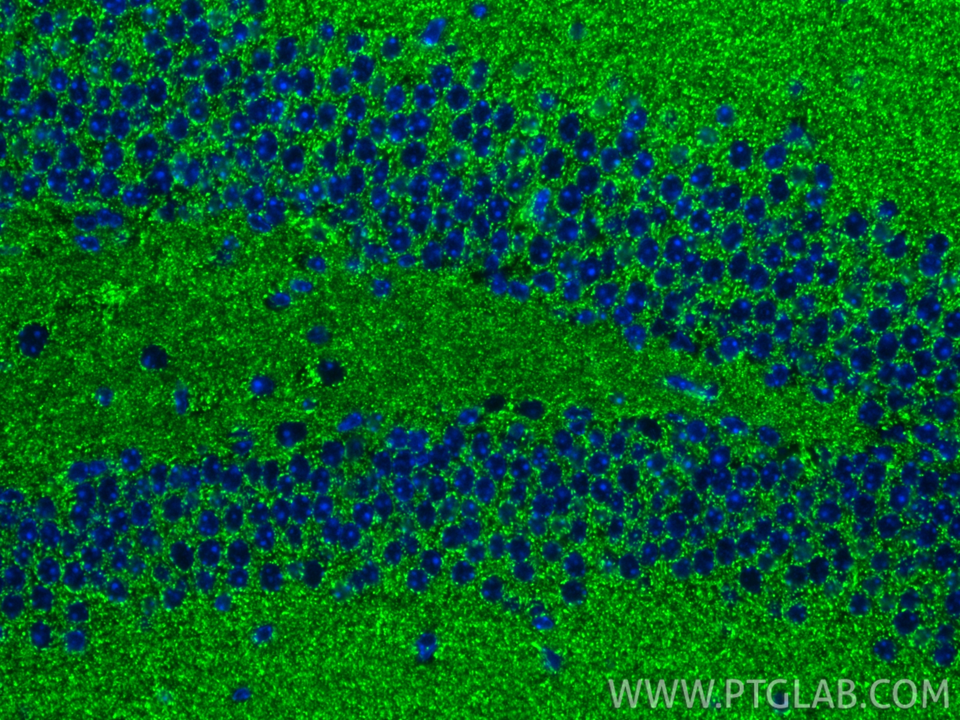 IF Staining of mouse brain using 85187-1-RR IF Staining of mouse brain using 85187-1-RR