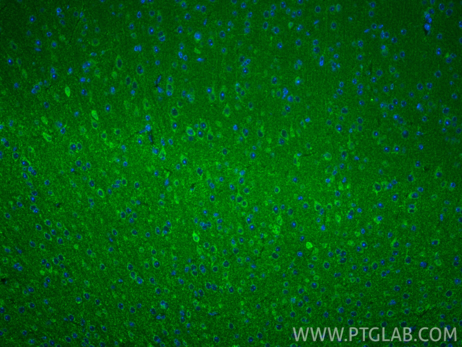 IF Staining of mouse brain using 15445-1-AP (same clone as 15445-1-PBS)