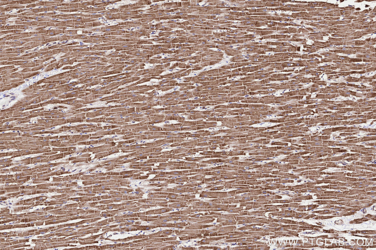 IHC staining of human heart using 15445-1-AP
