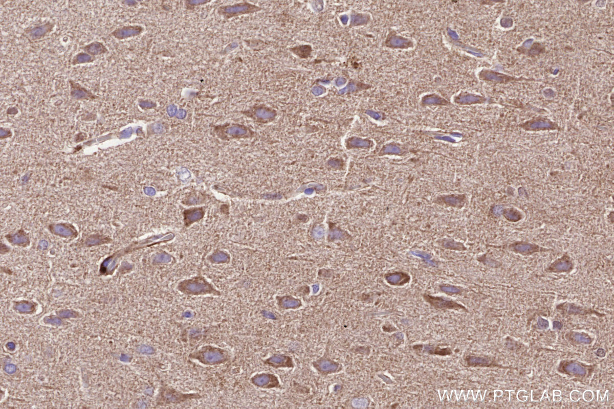 IHC staining of rat brain using 15064-1-AP IHC staining of rat brain using 15064-1-AP