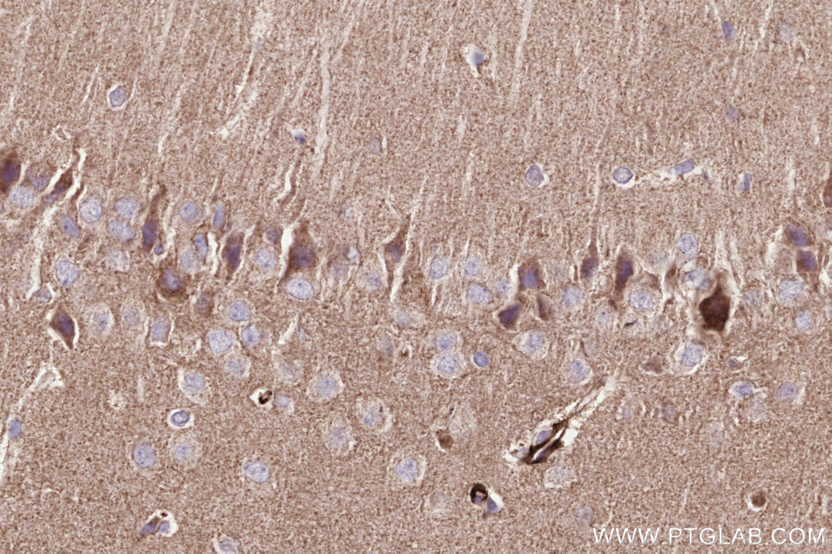 IHC staining of rat brain using 15064-1-AP IHC staining of rat brain using 15064-1-AP