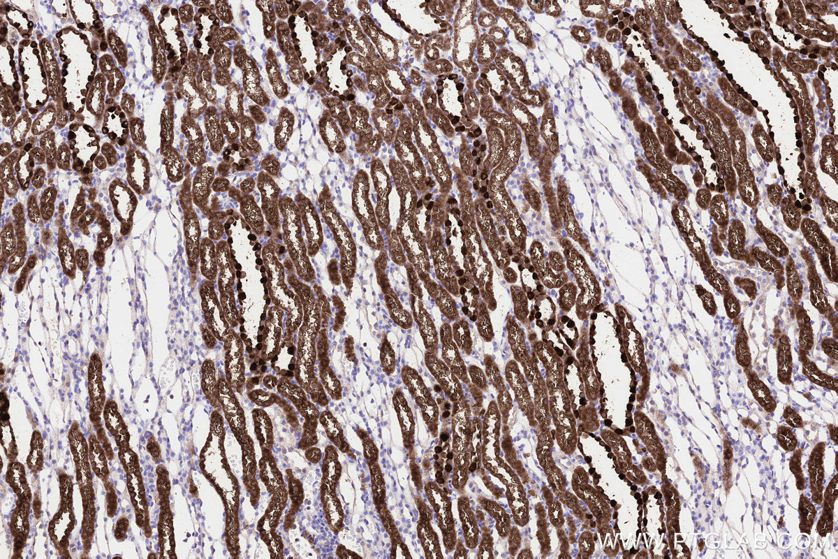 IHC staining of rat kidney using 15064-1-AP IHC staining of rat kidney using 15064-1-AP