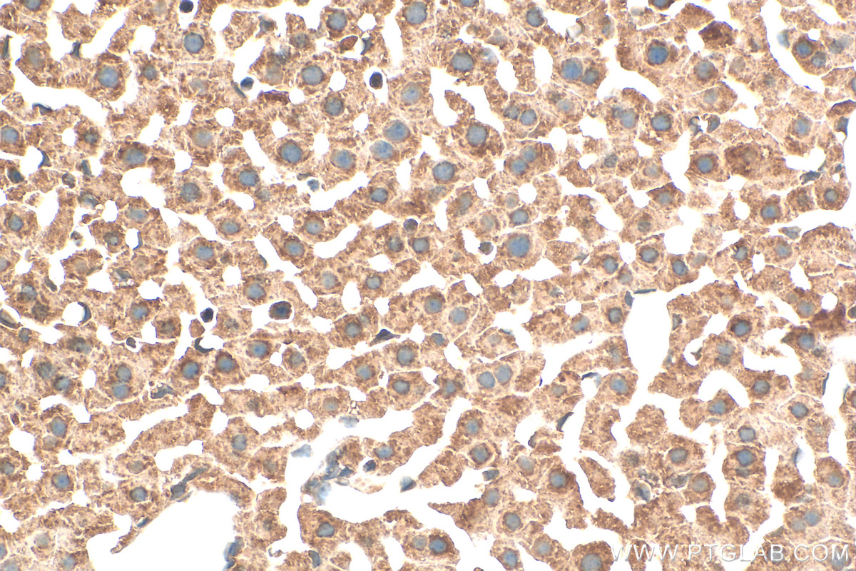 IHC staining of mouse liver using 20312-1-AP