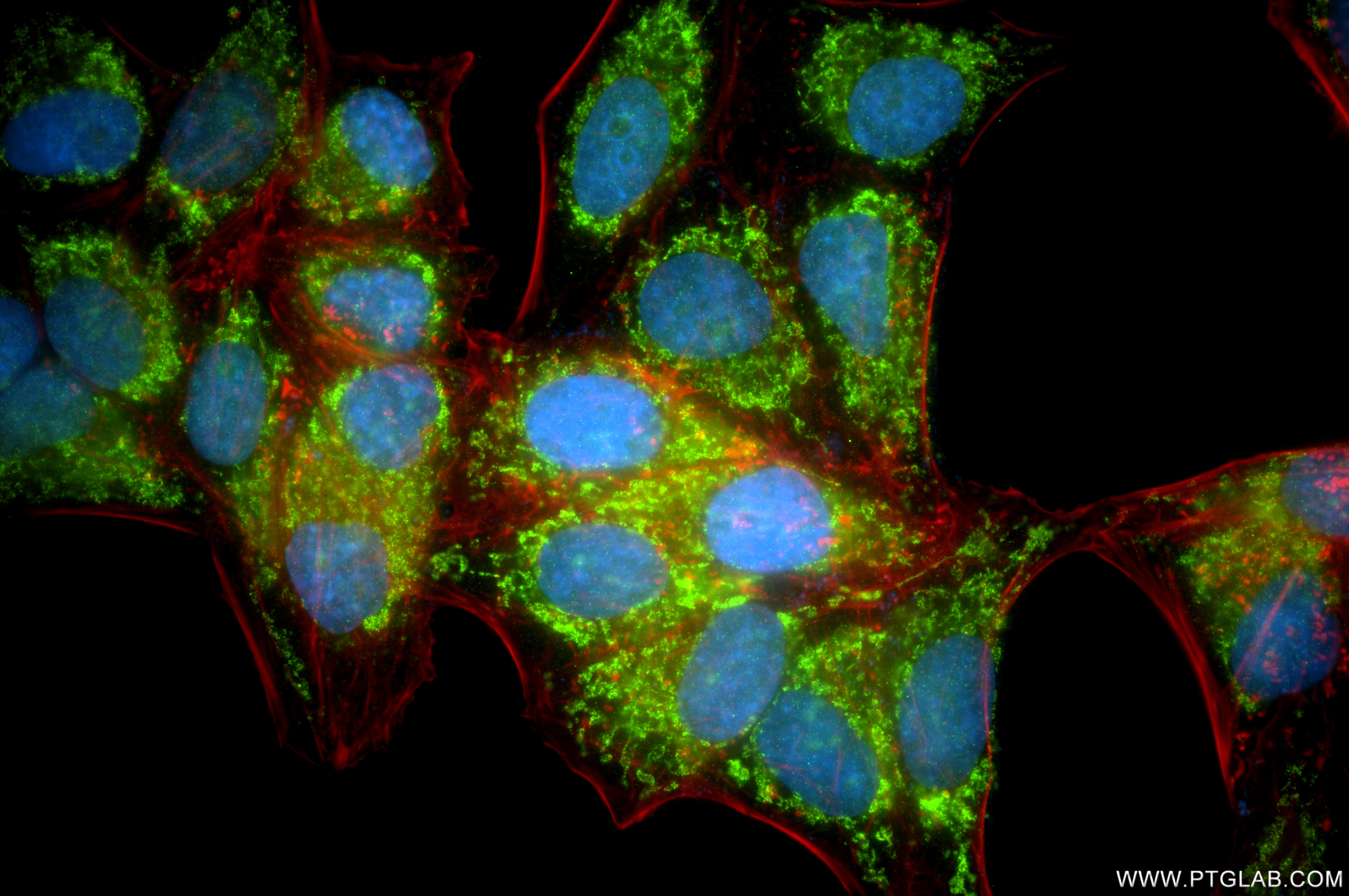 IF Staining of HeLa using 87143-2-RR IF Staining of HeLa using 87143-2-RR