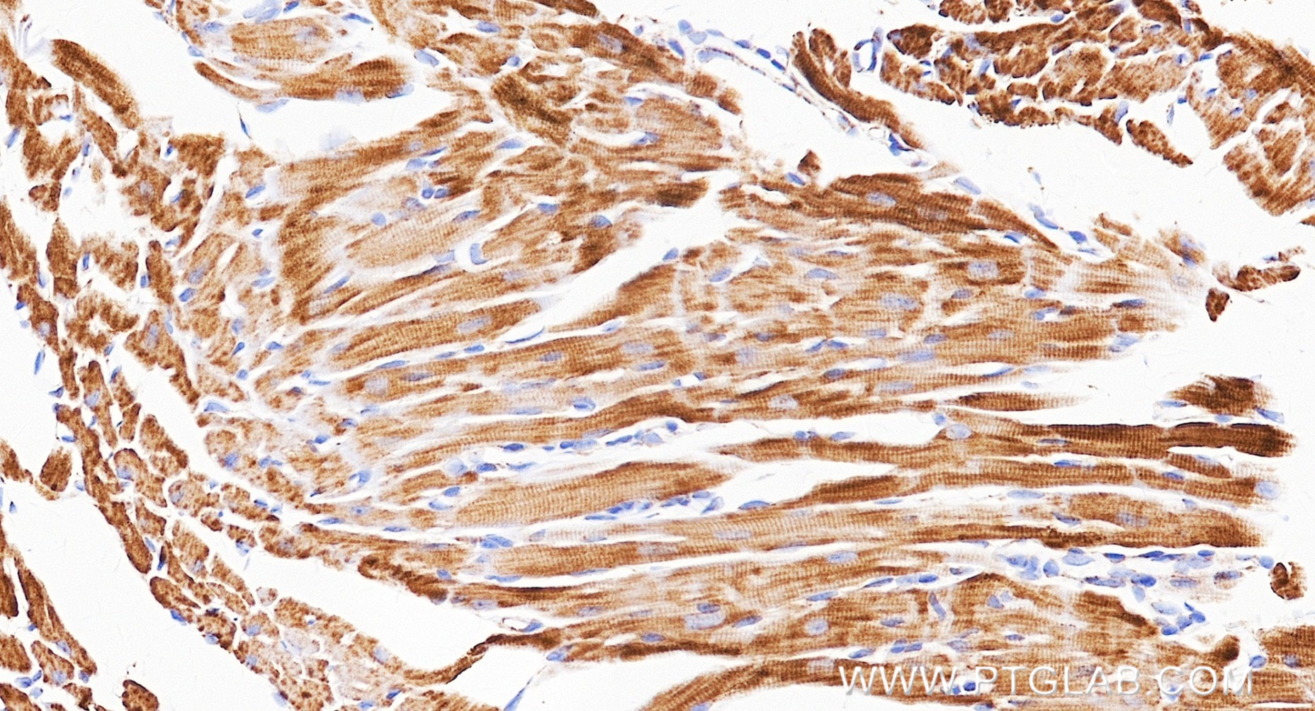IHC staining of mouse heart using 87143-2-RR IHC staining of mouse heart using 87143-2-RR