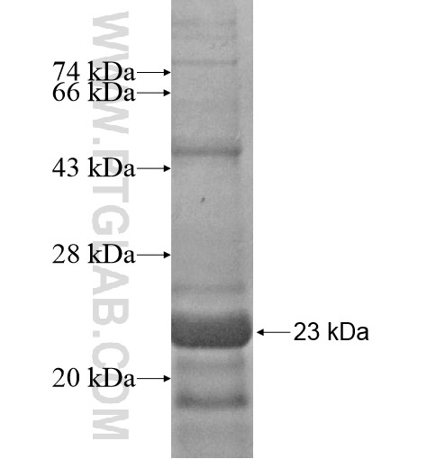 NDUFAB1 fusion protein Ag13494 SDS-PAGE NDUFAB1 fusion protein Ag13494 SDS-PAGE