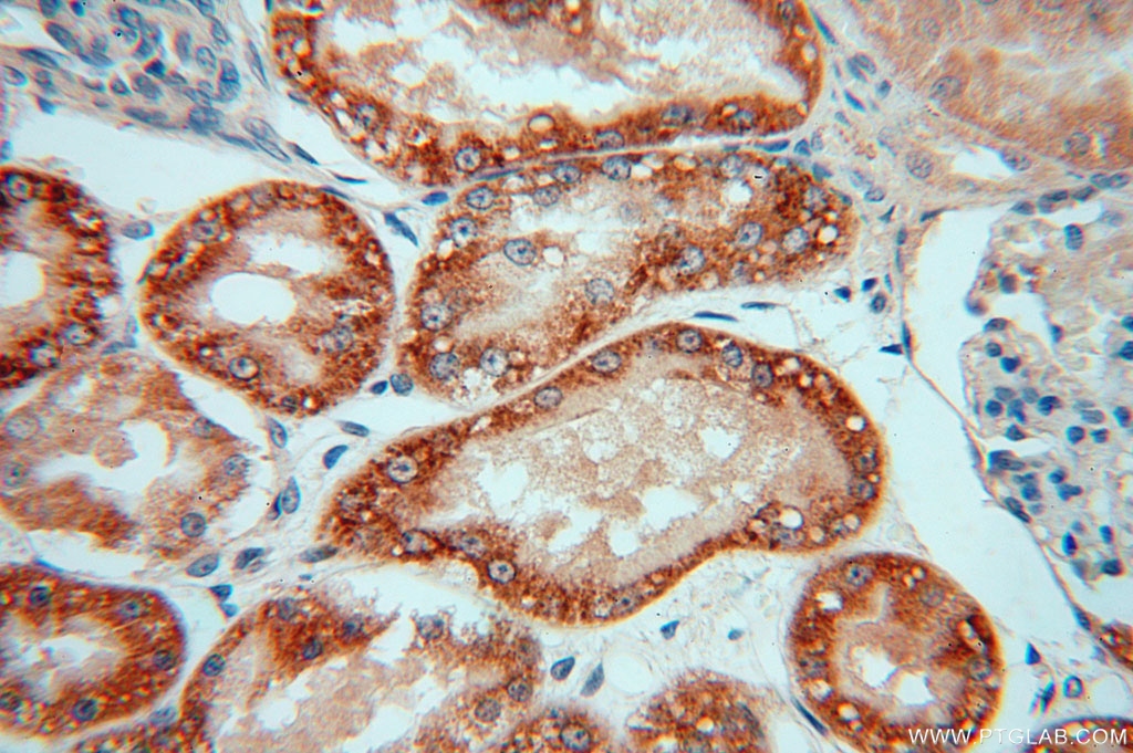 IHC staining of human kidney using 15181-1-AP