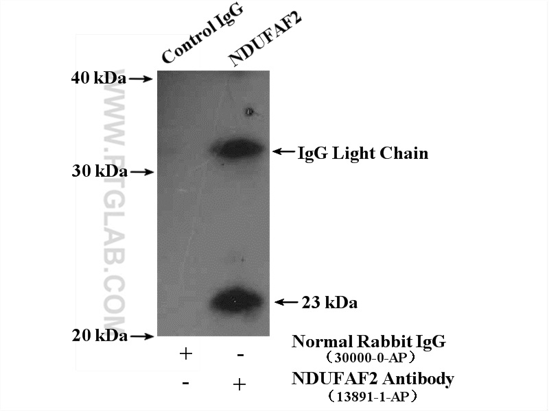 IP experiment of SH-SY5Y using 13891-1-AP