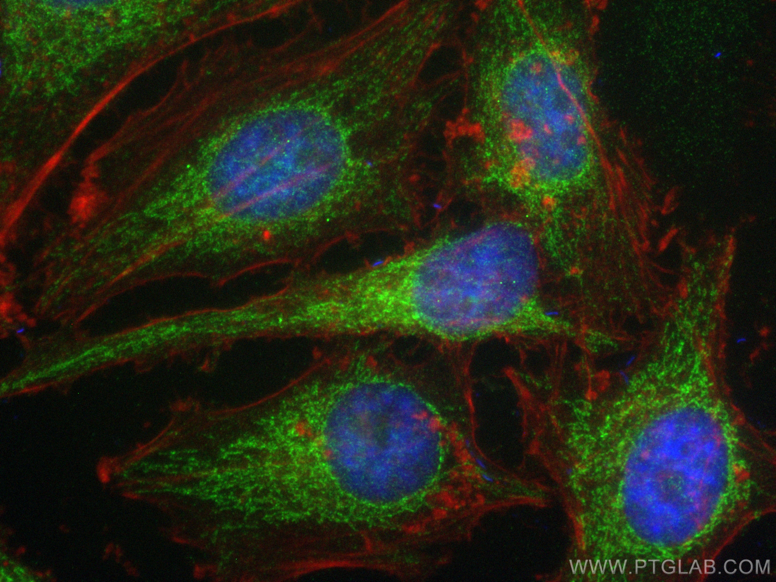 IF Staining of HeLa using 25621-1-AP