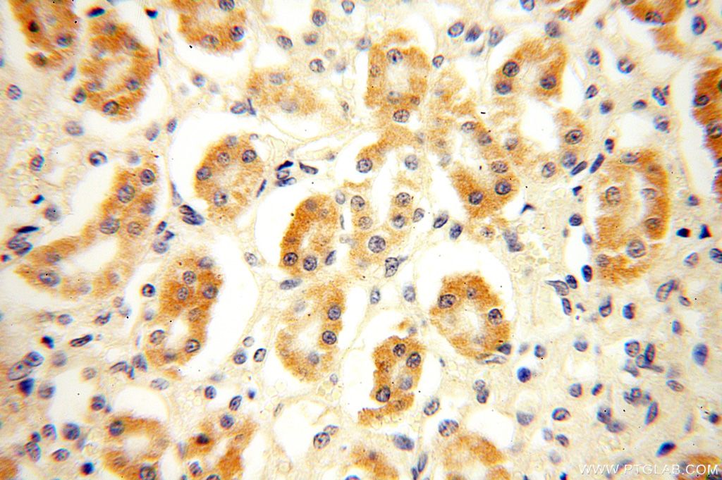 IHC staining of human kidney using 16902-1-AP