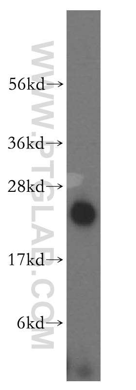 WB analysis of HepG2 using 15589-1-AP